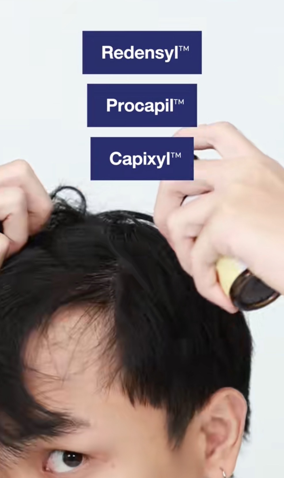 ผมบางอย่าเพิ่งถอดใจ…เรามีตัวช่วย!!🥳