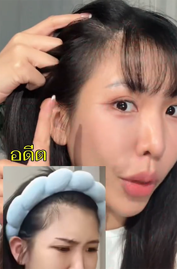 ขอร้องง ถ้าใครมีงบลองหน่อยยยส่วนตัวคือชอบมากก เบบี้แฮร์ขย้นขึ้นเว่อออ ใครใช้ของ @nectapharma อยู่แล้วชอบเหมือนกันเม้นๆๆหน่อย #IntensiveHairSerum 
#Nectapharma #เนคตาฟาร์มา