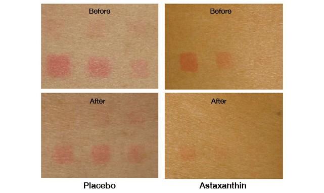 วิตามินบำรุงผิว Luminari Astaxanthin
`ยืนยันผลลัพธ์ด้วยงานวิจัย`