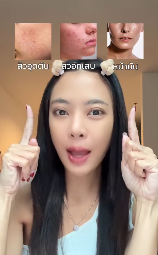 เจอแล้วตัวช่วยปัญหาสิวที่ครบจบในขวดเดียว Bioactive Acne Clear Serum ของ Nectapharma ตอนนี้เป็นลูกรักไปแล้ว💕✨
#สิวซิ่วเซรั่ม #BIOACTIVEAcneClearSerum
#Nectapharma