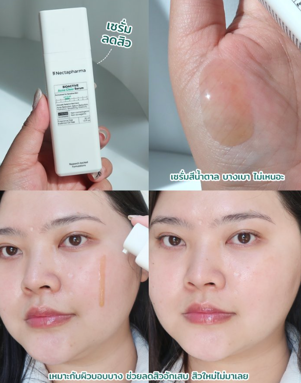 ถึงไม่ค่อยเป็นสิว แต่ติดใช้เซรั่มลดสิวตลอดเลย เพราะมันช่วยให้สิวใหม่ไม่มานี่ล่ะ ช่วงนี้ใช้ Nectapharma ขวดสีเขียวอยู่ สิวใหม่ไม่ผุดเลย ช่วยลดรอยสิวเก่าและสิวอุดตันด้วย ช่วยเติมความชุ่มชื้น แล้วทำให้ผิวมันน้อยลง รอยดำก็ดูจางลงด้วย ดีงามมม