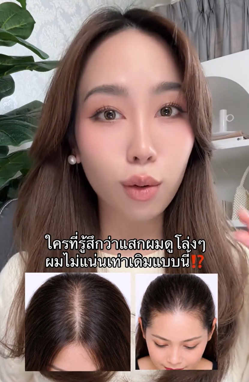 ใครที่รู้สึกว่าตรงรอยแสกมันดูโล่งๆ กว่าเมื่อก่อน แบบผมไม่ค่อยแน่นเท่าเดิมต้องมีสิ่งนี้ของ #Nectapharma‼️✨ #IntensiveHairSerum #tiktokป้ายยา #รีวิวบิวตี้