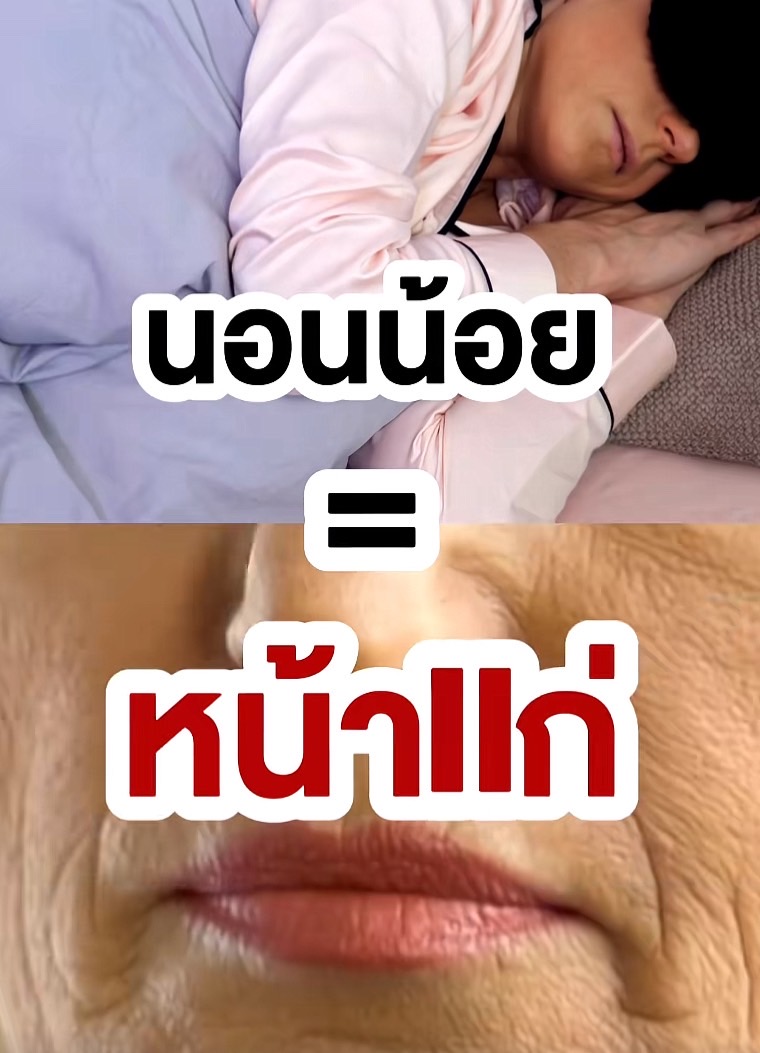 รู้ไหม? นอนน้อย = หน้าแก่ 💤