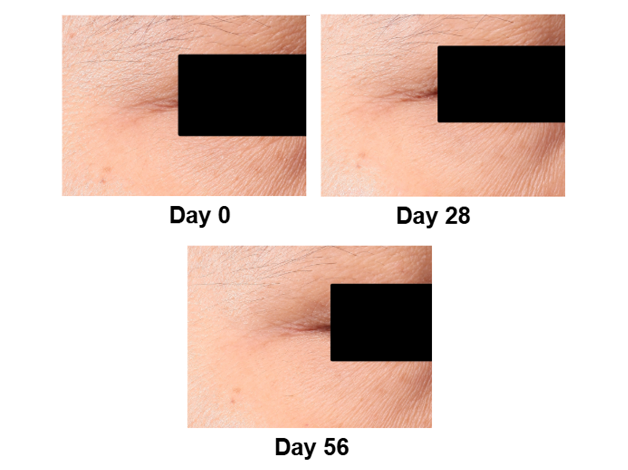 `เรตินอลจาก Nectapharma`
Dual Booster Encap 0.1 Retinol Serum ยืนยันผลลัพธ์ด้วยผู้ใช้จริง