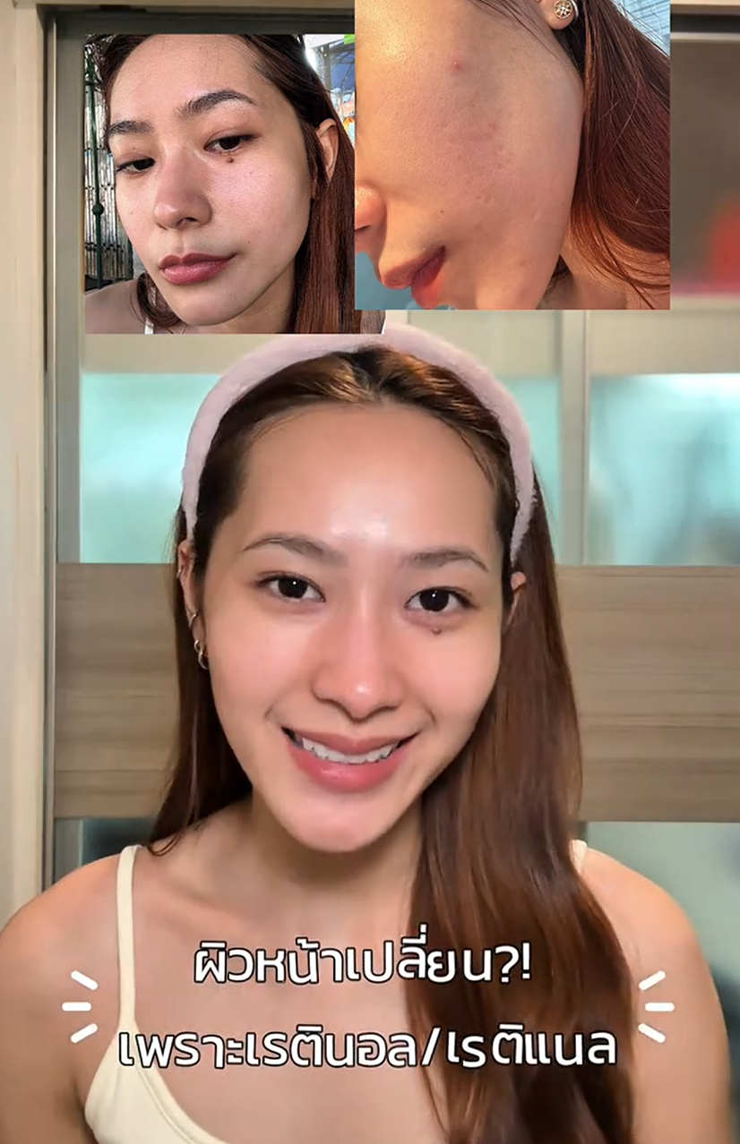 แล้วฉันใ้ช้จริงทั้ง 2 ตัวเลย!!🥺💜🩷 #DualEncapRetinalSerum #ตึงแนลเซรั่ม #Nectapharma #เนคตาฟาร์มา