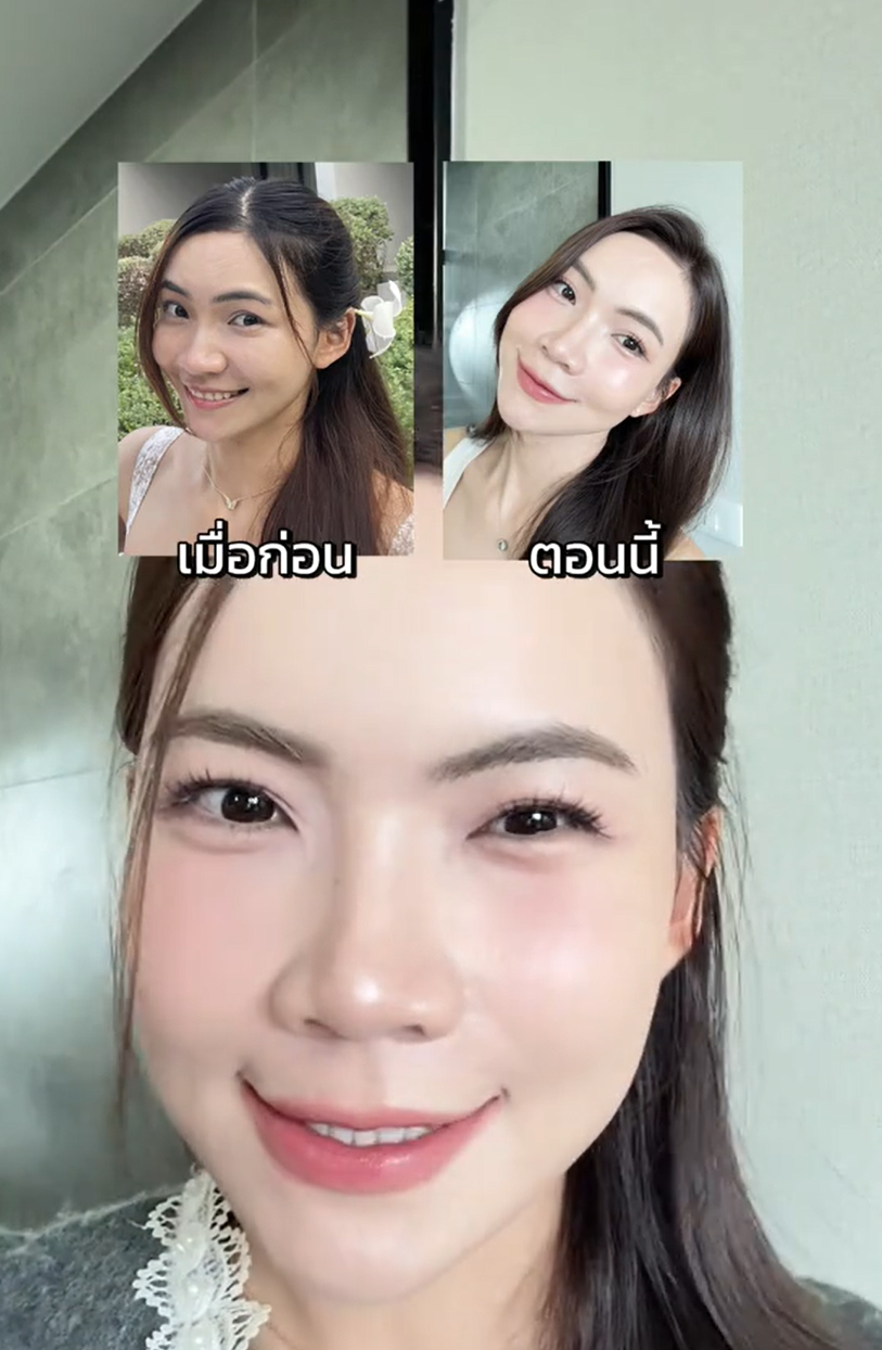งานผิวดูเด็กคือต้องมา! #รีวิวบิวตี้ #DualEncapRetinalSerum #ตึงแนลเซรั่ม #Nectapharma #เนคตาฟาร์มา