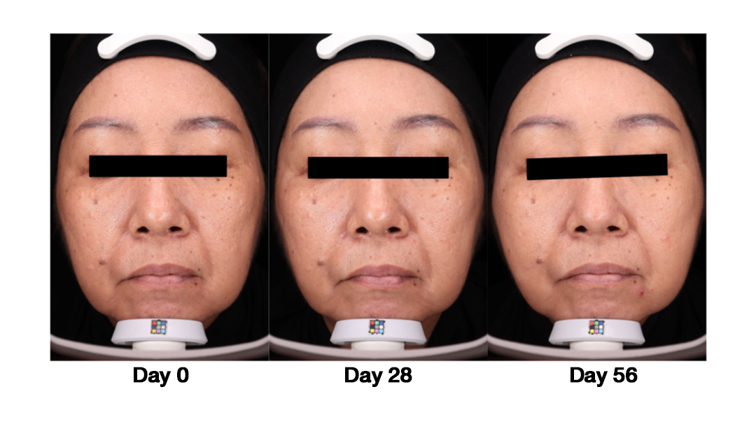 `เรติแนลจาก Nectapharma`
AGELESS DUAL ENCAP 0.1 Retinal Serum ยืนยันผลลัพธ์ด้วยผู้ใช้จริง