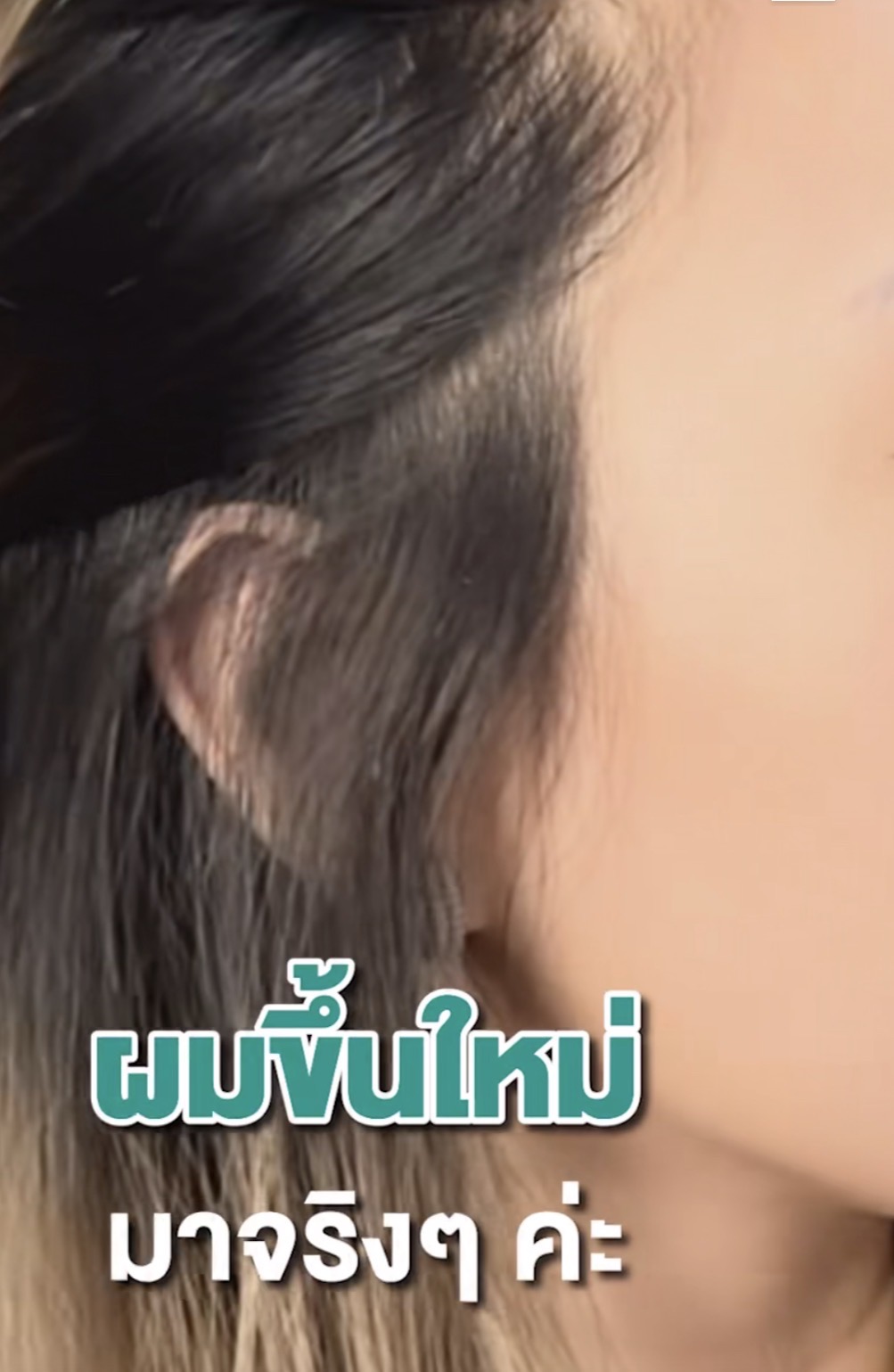 👍✨ แนะนำเลย! ไอเทมบอกลาผมบาง สร้างผมหนามั่นใจ ทำทรงไหนก็สวย💖