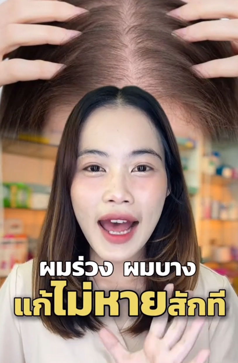 จัดการปัญหาผมร่วงแบบใหม่ ดูแลผมงอกใหม่ลึกถึงระดับยีน ให้ลึกถึงระดับยีน 
เลือกให้วิตามินผม Revitafol จาก Nectapharma 
#Revitafol #วิตามินแฮร์เกิดสูตรใหม่ #Nectapharma #เนคตาฟาร์มา