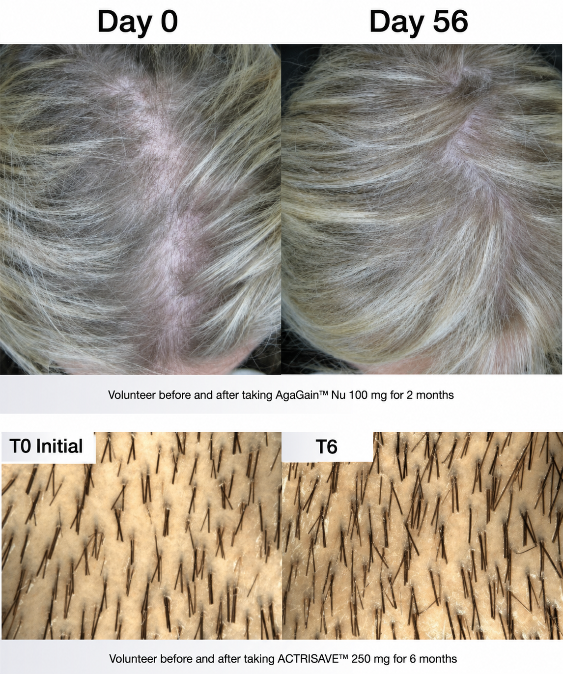 `Revitafol Hair Loss Supplement Backed by Clinical Research`