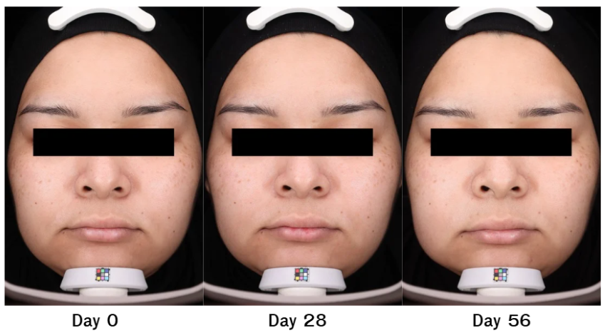 `^เซรั่มผิวกระจ่างใส Nectapharma^ ^Skin Radiance Whitening Serum^ ^ยืนยันผลลัพธ์ด้วยผู้ใช้จริง^`