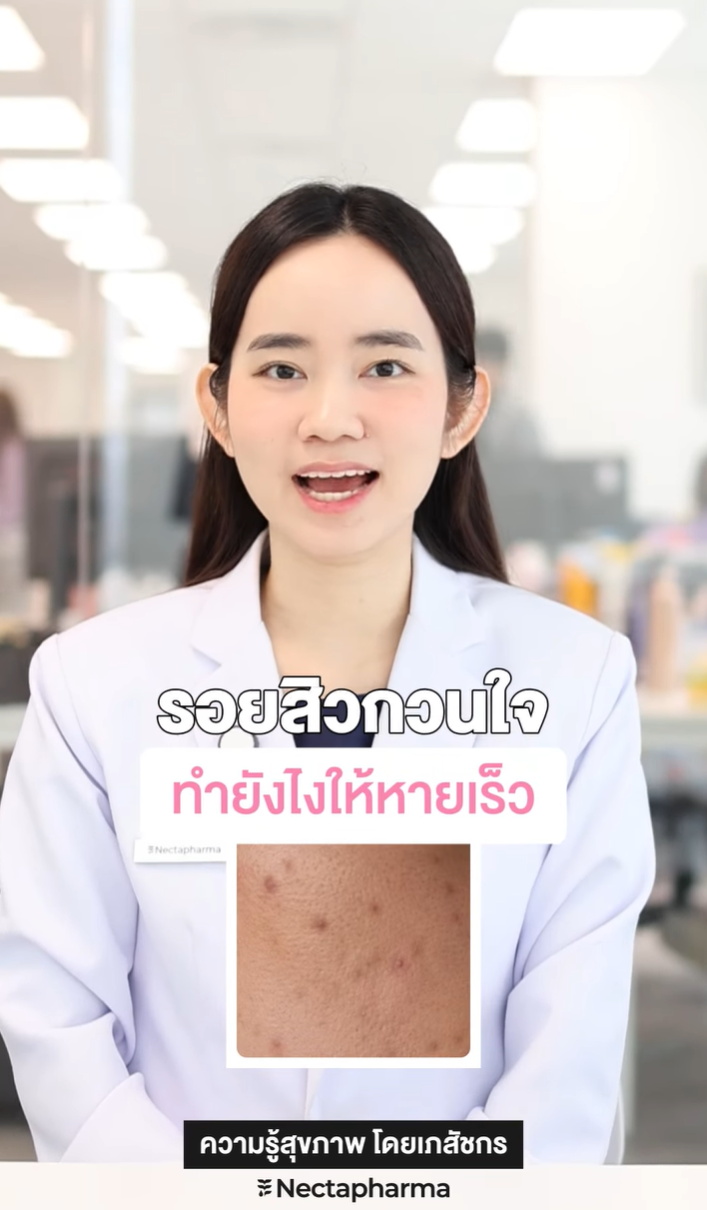 รอยสิวกวนใจ ทำยังไงให้หายเร็ว 🧐
แจกเคล็ดลับดูแลรอยสิว ฉบับผู้เชี่ยวชาญ ✨
#ความรู้สุขภาพโดยเภสัชกร