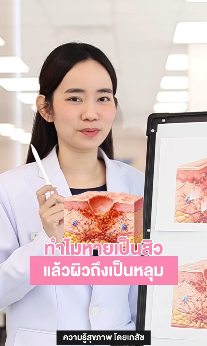ทุกคนเคยสงสัยกันมั้ย ? ทำไมหายเป็นสิวแล้วผิวถึงเป็นหลุม 🧐
ไขคำตอบได้ที่คลิปนี้ 🔍✨
#ความรู้สุขภาพโดยเภสัชกร