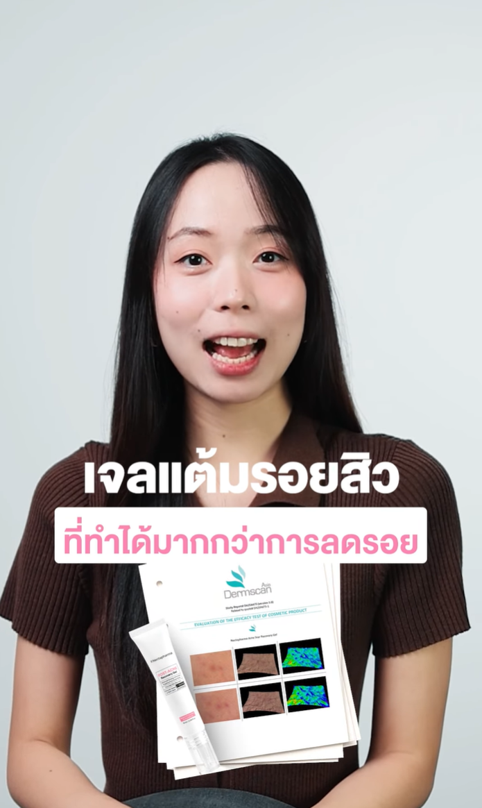 เจลแต้มรอยสิวที่ทำได้มากกว่าการลดรอย ✨

Post Acne Recovery Gel ผ่านการทดสอบจากผู้ใช้จริง รอยสิวดูจางลงใน 7 วัน
เมื่อใช้ครบ 28 วัน พบว่า
✅ รอยดำจากสิวสว่างขึ้น
✅ รอยสิวเล็กลง
✅ ผิวที่เป็นสิวดูเรียบเนียนขึ้น

📊ผลการทดสอบภายใต้การดูแลของแพทย์ผิวหนังจากสถาบันวิจัย Dermscan Asia