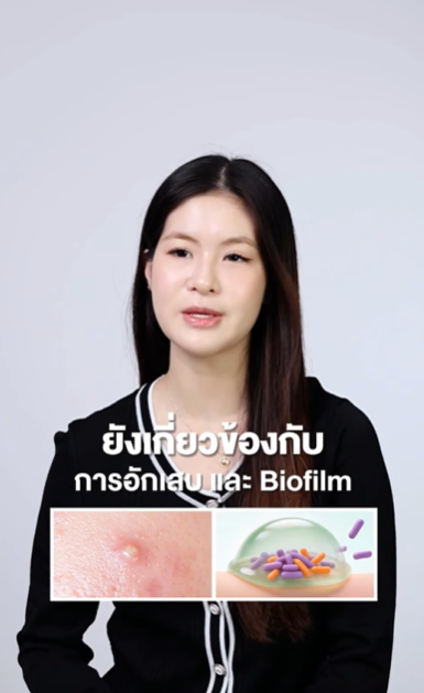 ทำไมสิวอักเสบบางเม็ด ถึงไม่ยุบสักที 🧏🏻‍♀️❓

เพราะสิวอักเสบ ไม่ได้มีแค่เรื่องเชื้อสิว แต่ยังเกี่ยวกับการอักเสบ และ Biofilm ซึ่งเป็นเกราะที่เชื้อสิวสร้างขึ้นมาเพื่อป้องกันตัวเอง จึงทำให้สิวบางเม็ดหายยาก และขึ้นซ้ำได้ 💥

💚 SOS Acne Spot Gel จาก Nectapharma จึงออกแบบมาเพื่อจัดการสิวอักเสบโดยเฉพาะ
✔️ SalSphere® Even Skin ปลดปล่อยสารเฉพาะจุดที่อักเสบ ด้วยเทคโนโลยี Smart Release Encapsulation ช่วยดูแลสิวโดยไม่รบกวนผิวรอบข้าง
✔️ WKPep® Anti-Acne Peptide ช่วยเรื่องชื้อสิว C. acnes และ S. aureus โดยไม่ทำลายเชื้อดีบนผิว
✔️ EQUIBIOME™ ช่วยเรื่องการเกิด Biofilm หนึ่งในสาเหตุที่ทำให้สิวขึ้นซ้ำ
✔️ Allium Cepa Extract ช่วยเรื่องการอักเสบและเชื้อจุลินทรีย์

เพราะบางครั้งการดูแลสิวอักเสบ อาจต้องดูแลมากกว่าแค่เรื่องเชื้อสิวนะคะ ✨