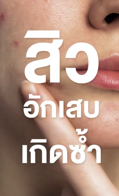 Biofilm สาเหตุที่สิวชอบขึ้นซ้ำ👀
.
🚨 SOS Acne Spot Gel เจลซ่อมสิว
ช่วยจัดการสิวอักเสบได้ลึกกว่าเดิม
✅ EQUIBIOME™ ช่วยลด Biofilm ได้สูงสุด 44%*
✅ WKPep® Anti-Acne Peptide ช่วยจัดการเชื้อสิว C. acnes โดยไม่รบกวนสมดุลผิว

#เจลซ่อมสิว จัดการสิวลึกถึงต้นตอ 💥