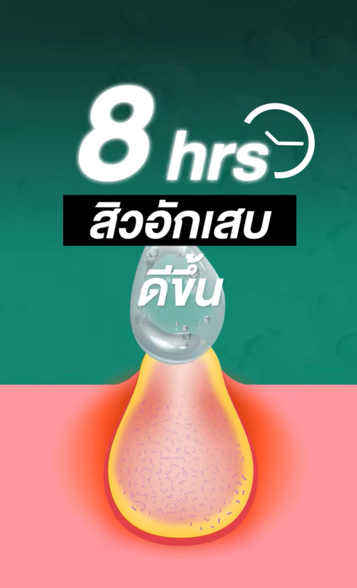 ใหม่! SOS Acne Spot Gel เจลแต้มสิว จาก Nectapharma
🚨ช่วยให้สิวอักเสบดีขึ้นภายใน 8 ชั่วโมง
✅ ลดการอักเสบ
✅ ลดเชื้อสิว C. acnes
✅ ลด Biofilm ที่ทำให้สิวกลับมาเป็นซ้ำ
.
⭐️ มีเทคโนโลยี Smart Release Encapsulation ที่จะปลดปล่อยสารสำคัญเฉพาะบริเวณอักเสบโดยไม่ทำร้ายผิวโดยรอบ
.
🔬 #เจลซ่อมสิว ทดสอบแล้วในคนจริง โดยทุ่มงบวิจัยกว่า 400,000 บาท