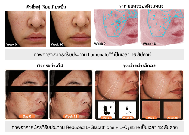 `Glumenato วิตามินผิวขาวใส ฉ่ำโกลว์ยืนยันผลลัพธ์ด้วยงานวิจัย`